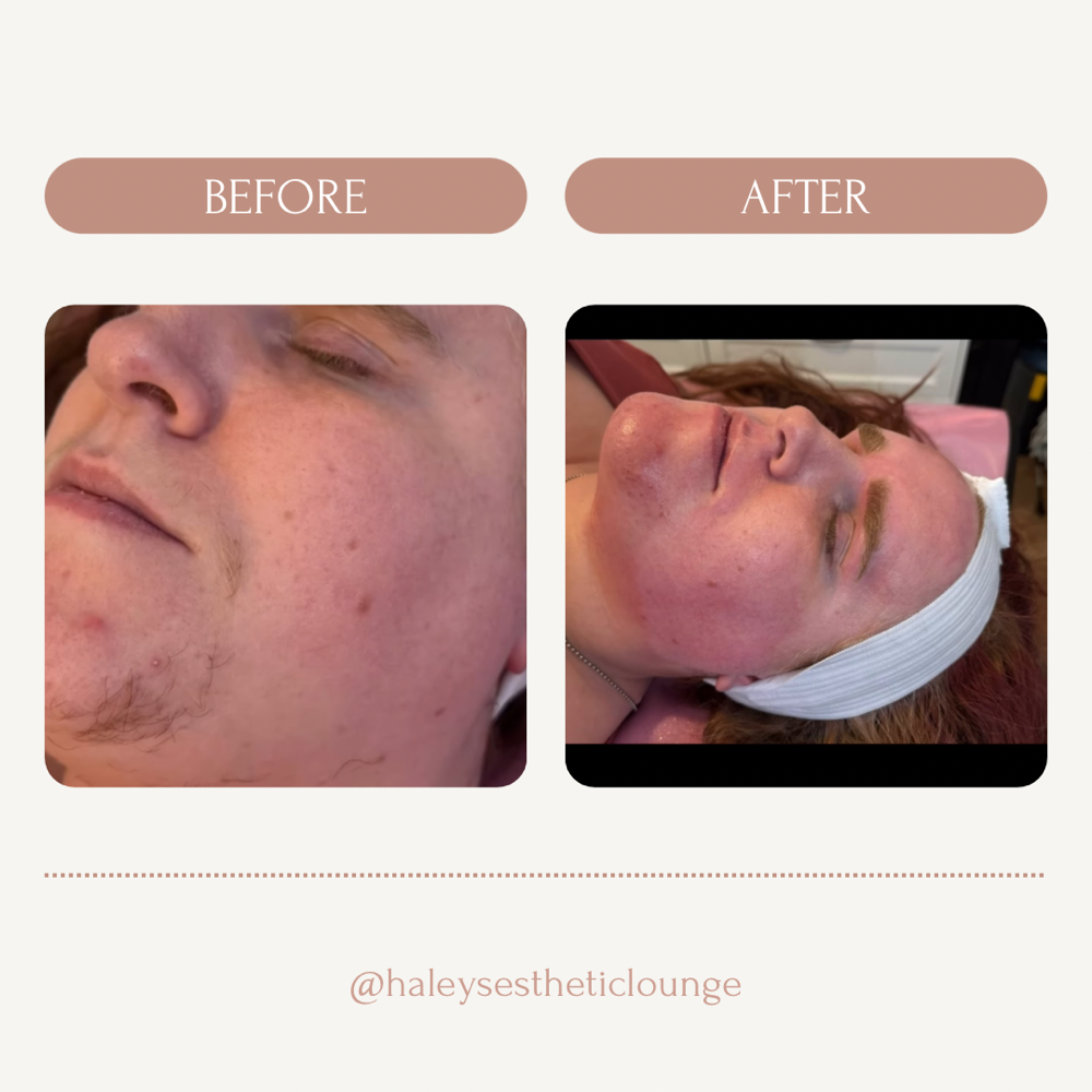 Full Face Wax
