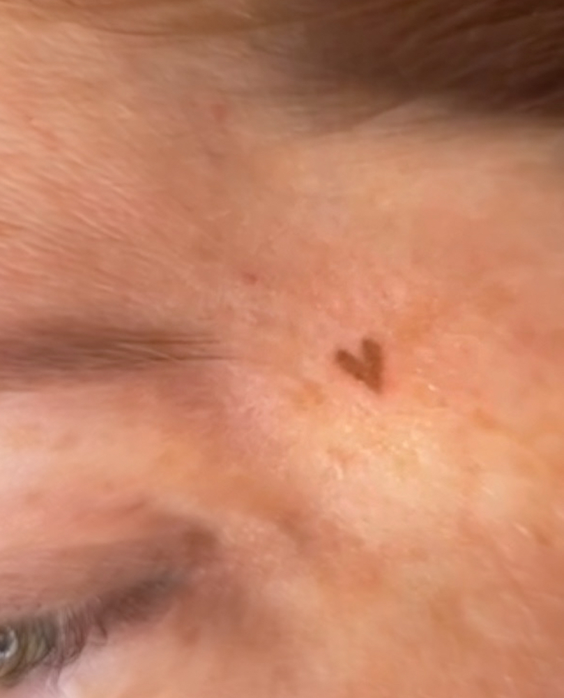 Designer Heart Freckle