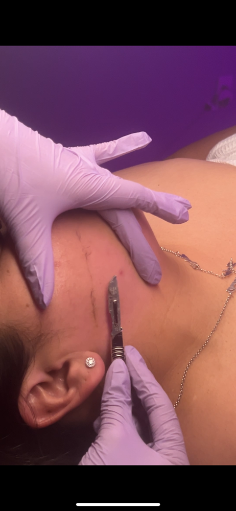 3 Dermaplane Facials