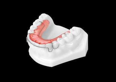 Retainer Fitting Set at BG Cosmetic in Inglewood, CA