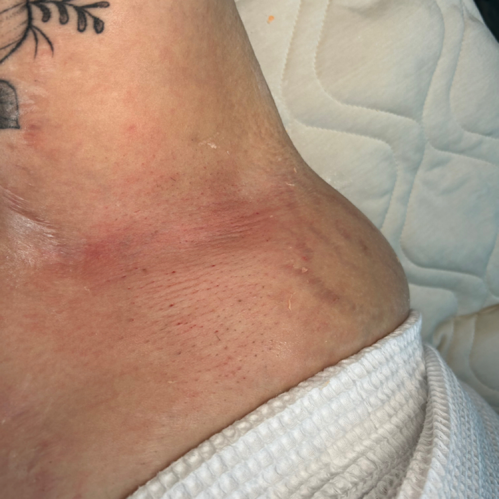 Underarm at Rooted in Nashville, AR