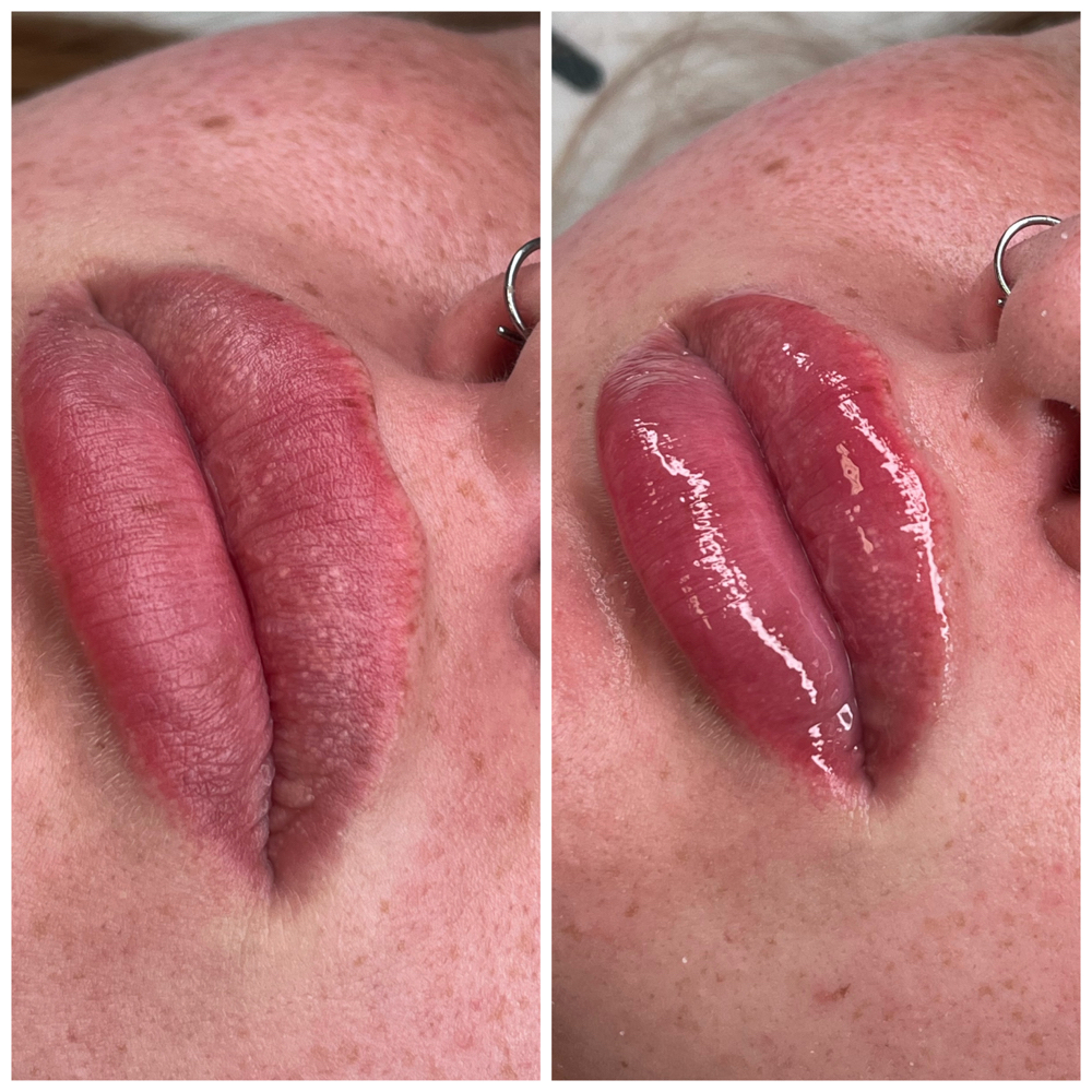 Hydragloss Lip Treatment