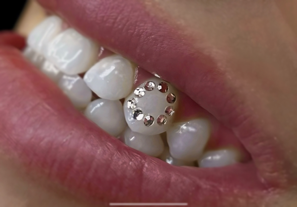 Tooth Gems (Halo)