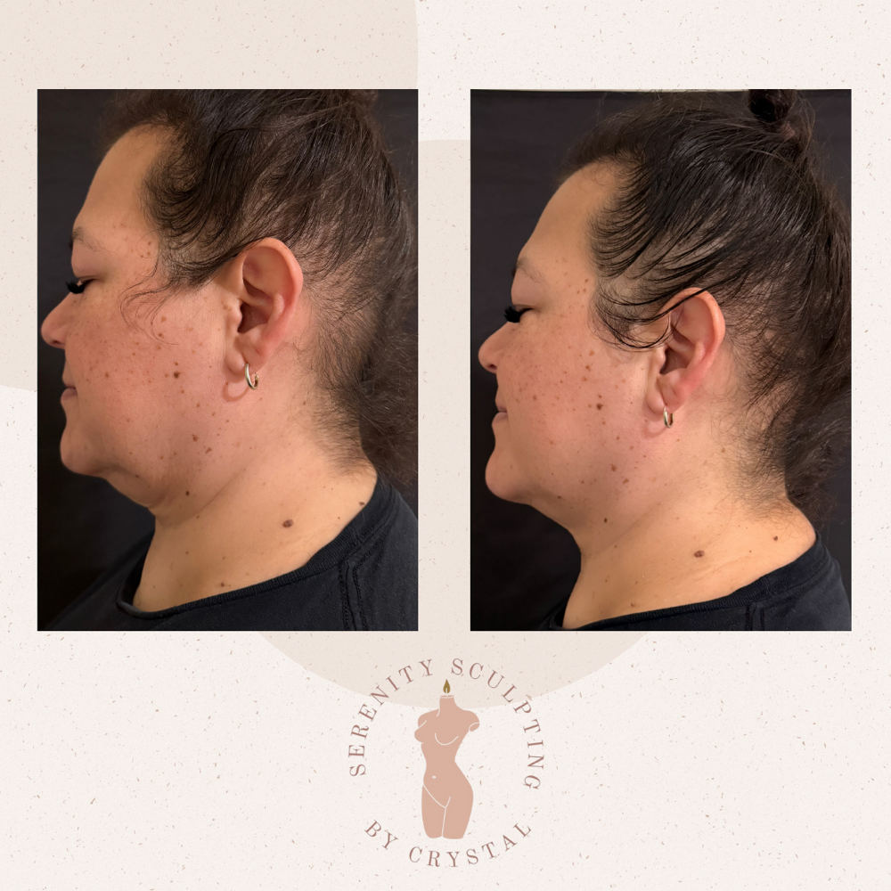 Glow & Define at Serenity Sculpting in Madera, CA