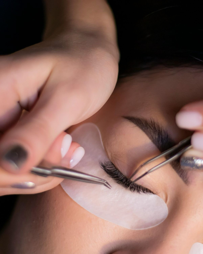 Classic Fill at Kayla Aesthetics in Longview, TX