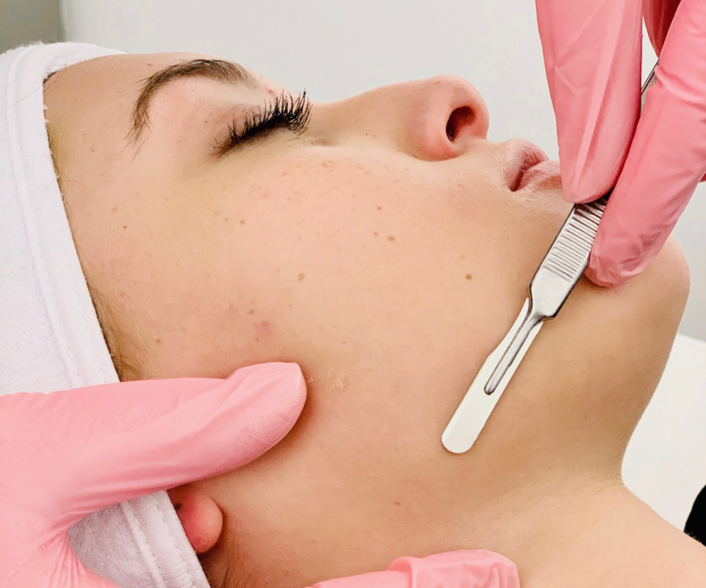 Dermaplaning only