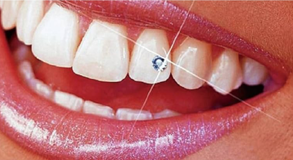 Tooth Gem Add On
