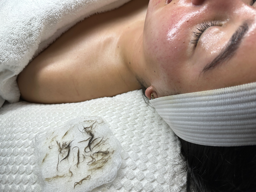 Simply Dermaplaning Facial