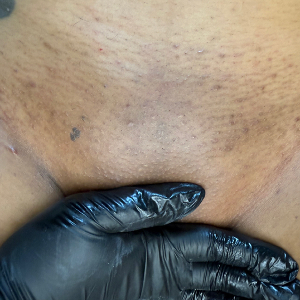 Brazilian Wax at Ombre By Brei Esthetics in Taylor, MI