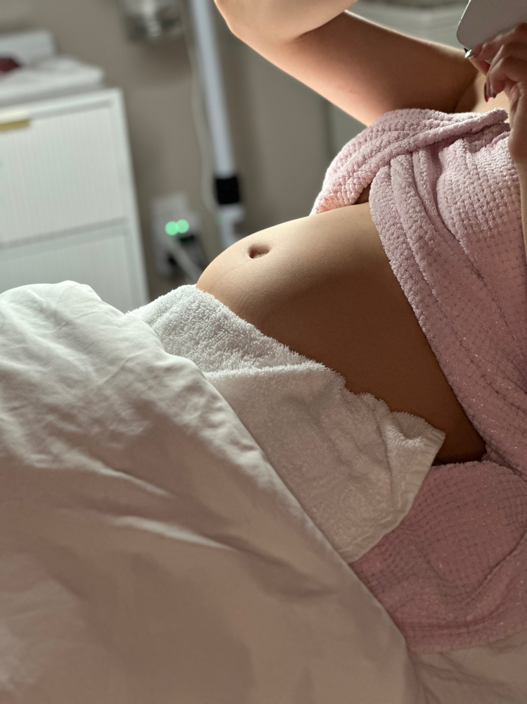 Baby Bump Facial