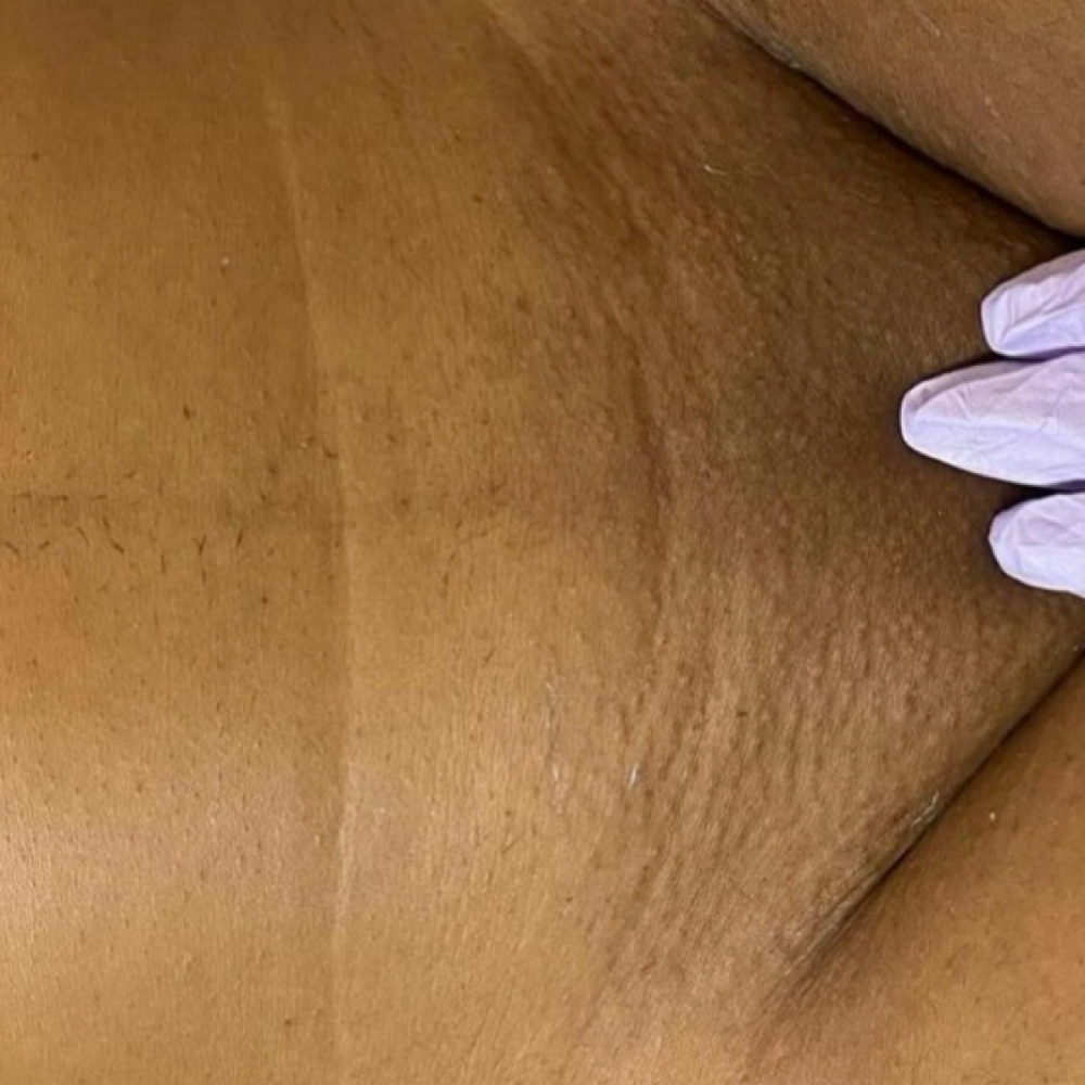 $50 Brazilian at PamperedByNaya in Ferndale, MI