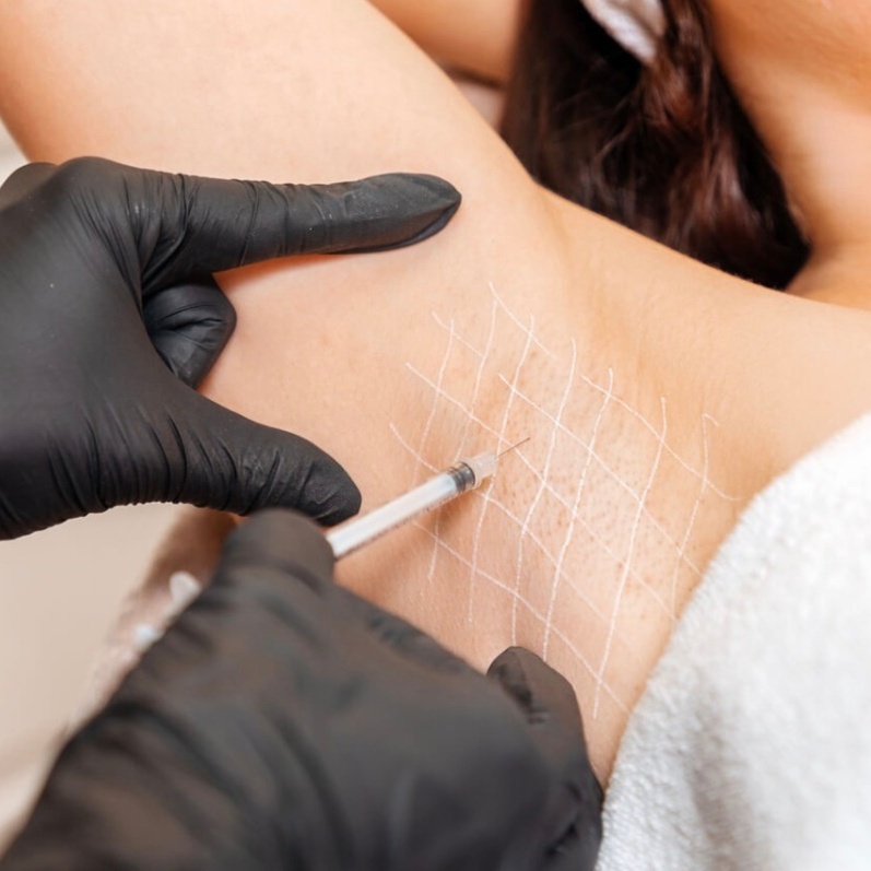 Hyperhidrosis (excessive sweating) at RevIVeU - Bridgeport in Bridgeport, WV