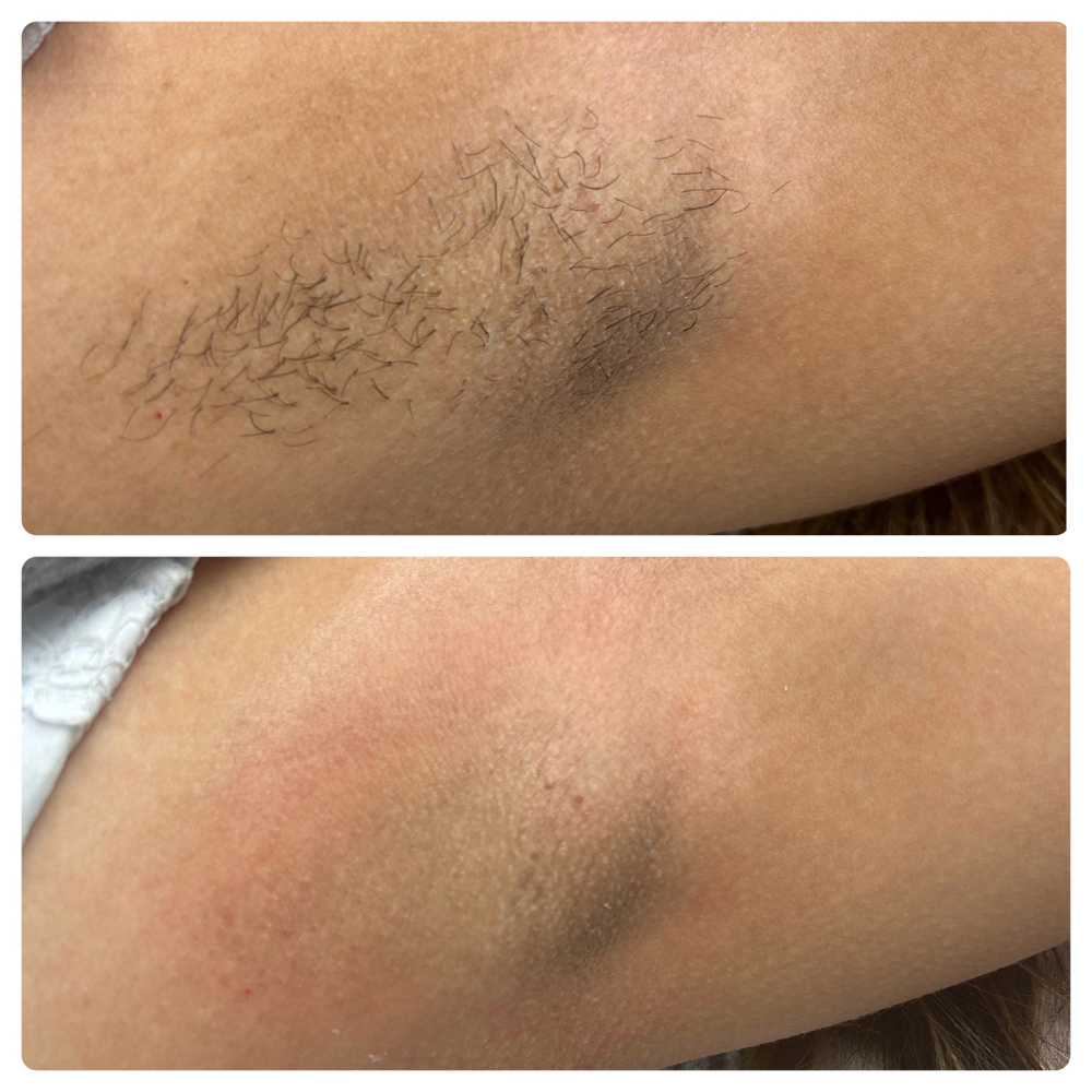Underarm Wax