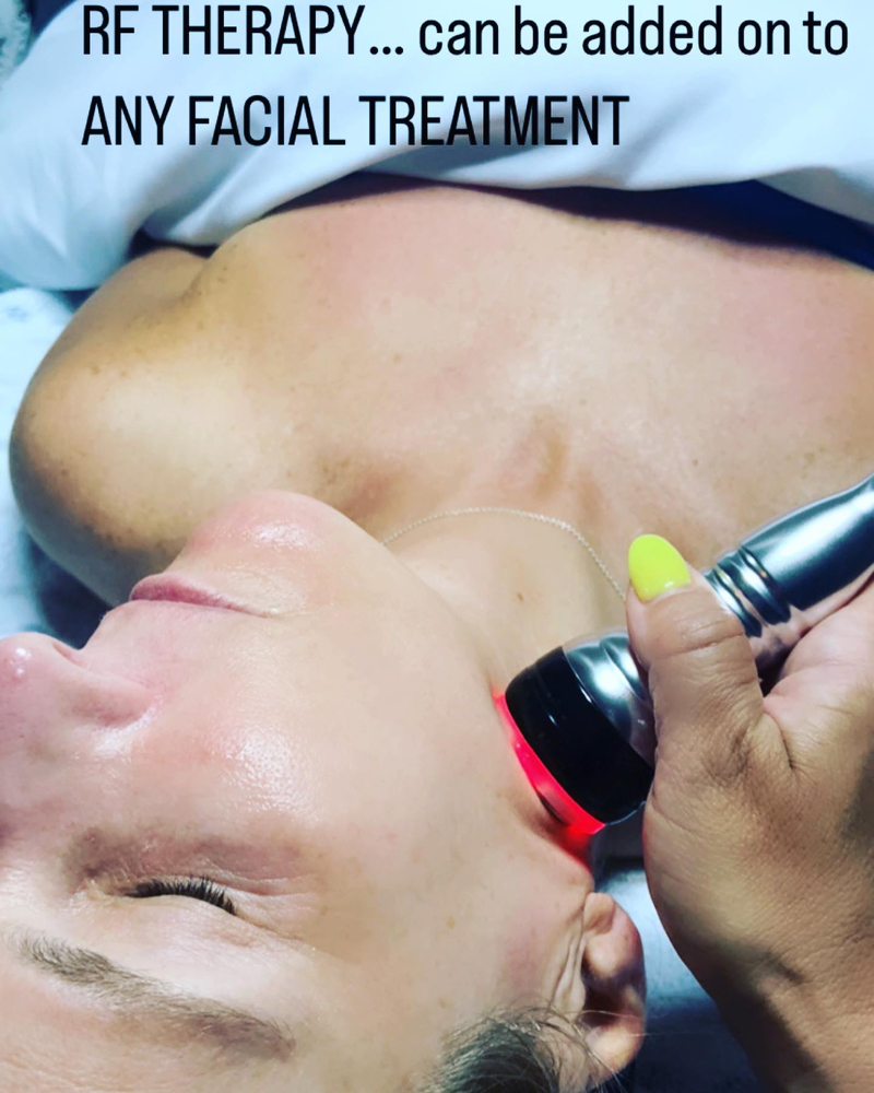 RF Skin Tightening Therapy Add On