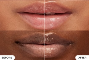 Lip Treatment