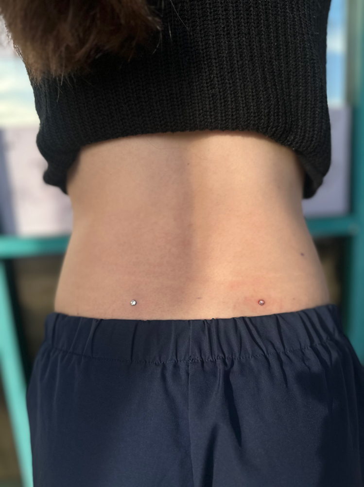 Back Dermals
