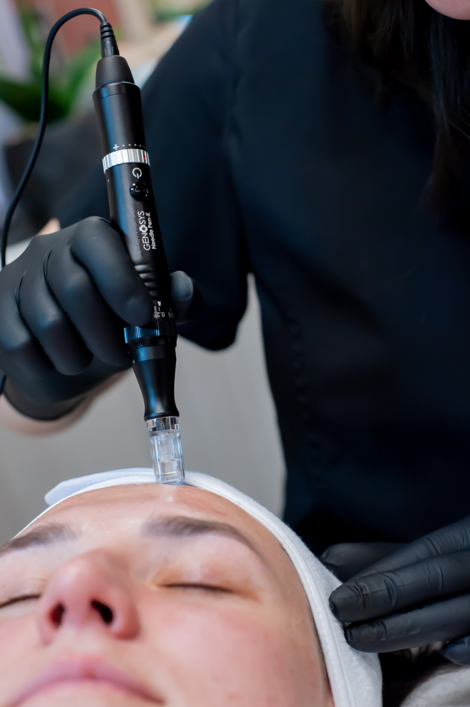 Décolleté(Chest)Add On Microneedl.