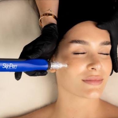SKINPEN + COLLAGEN RENEWAL 60 MIN at Mercedes Parra in Mokena, IL
