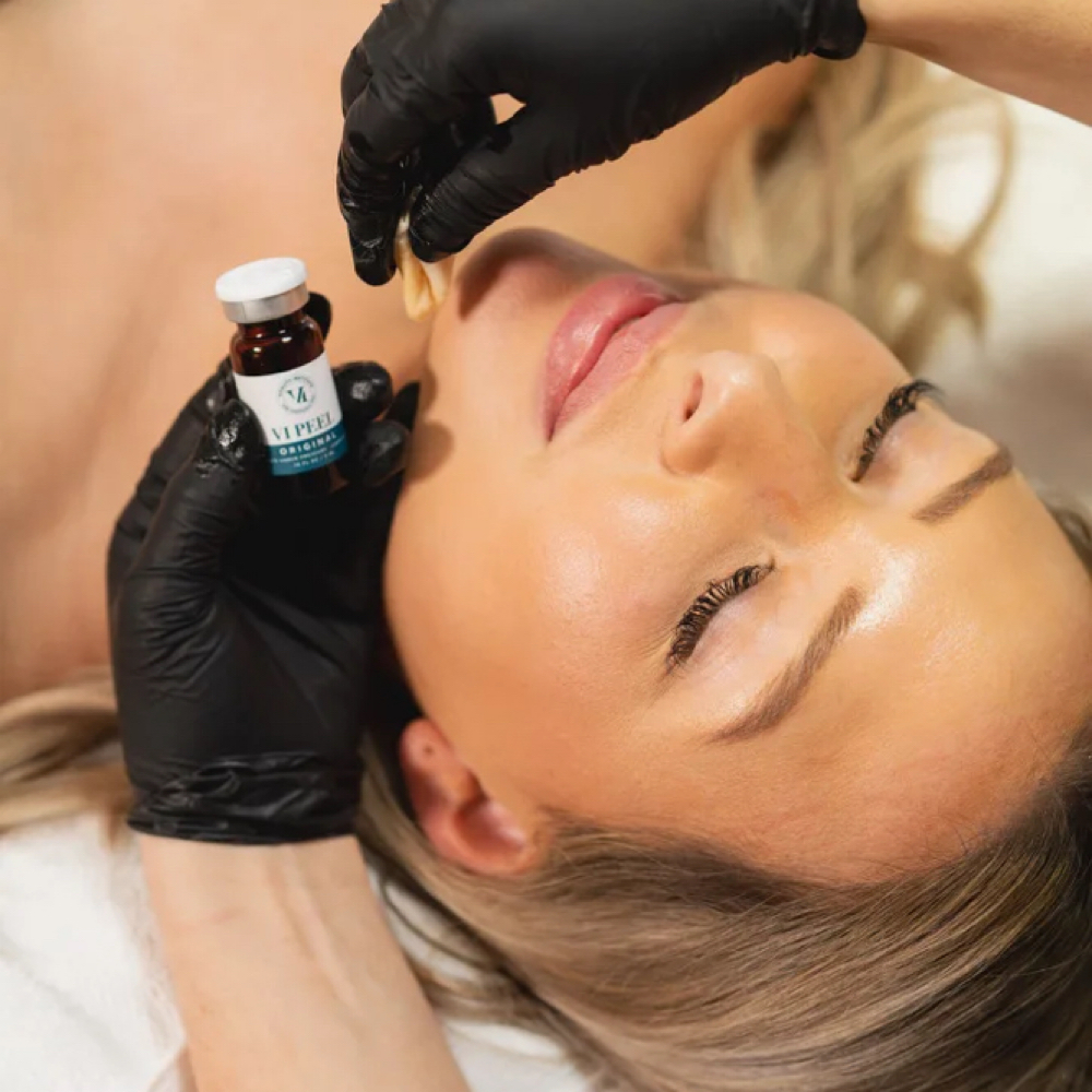VI Peel at Vain Beauty Aesthetics in De Queen, AR