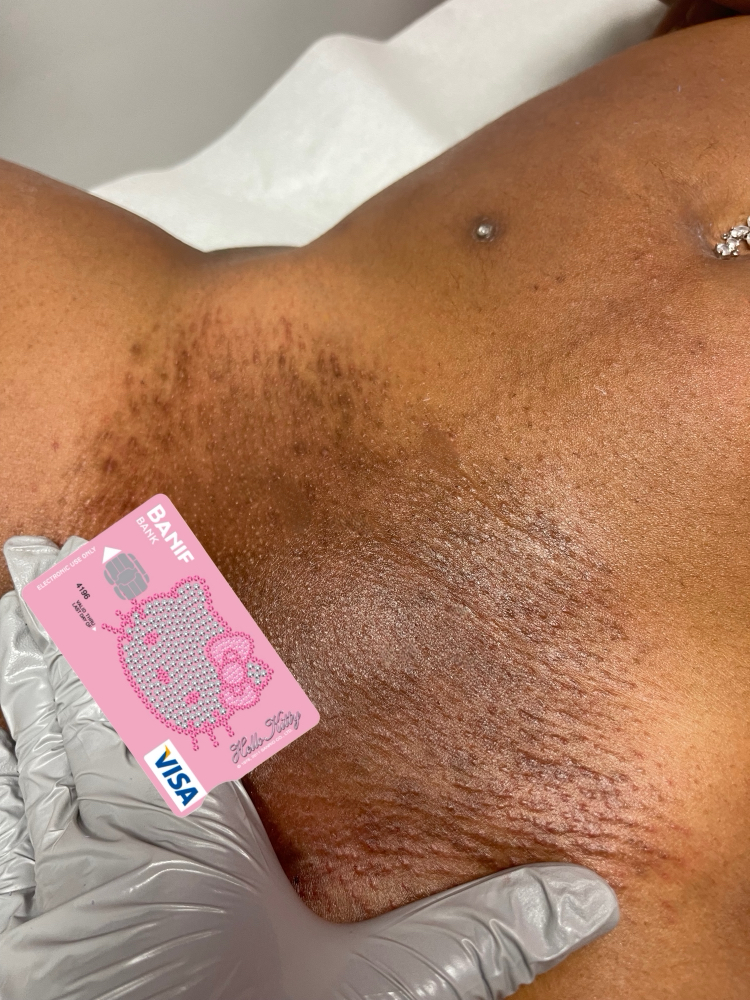 Pretty Kitty Brazilian Wax