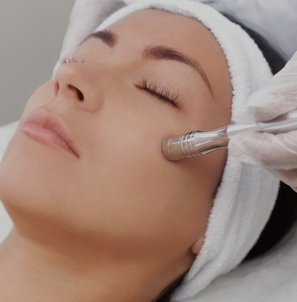 Microdermabrasion Add On