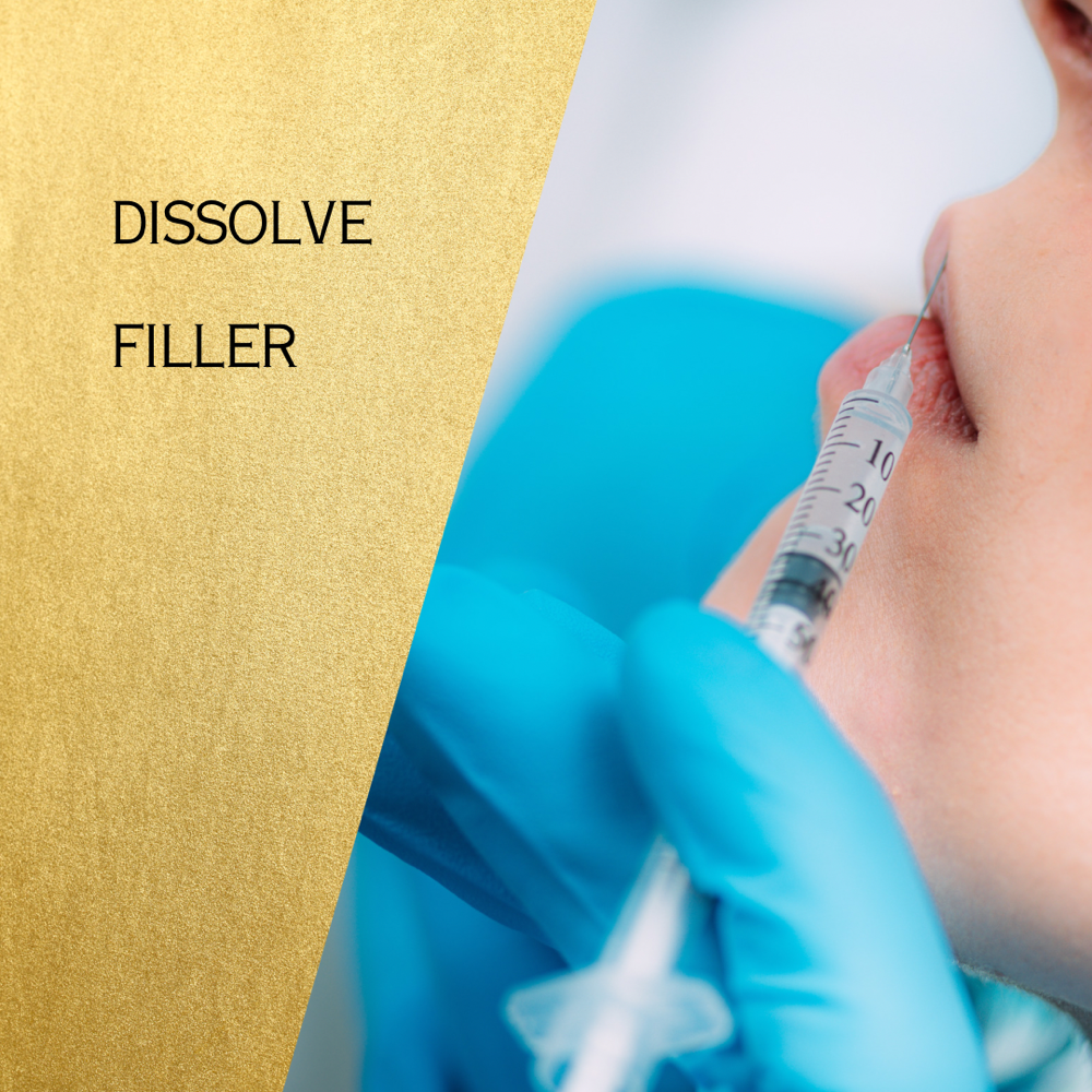 Dissolve Filler