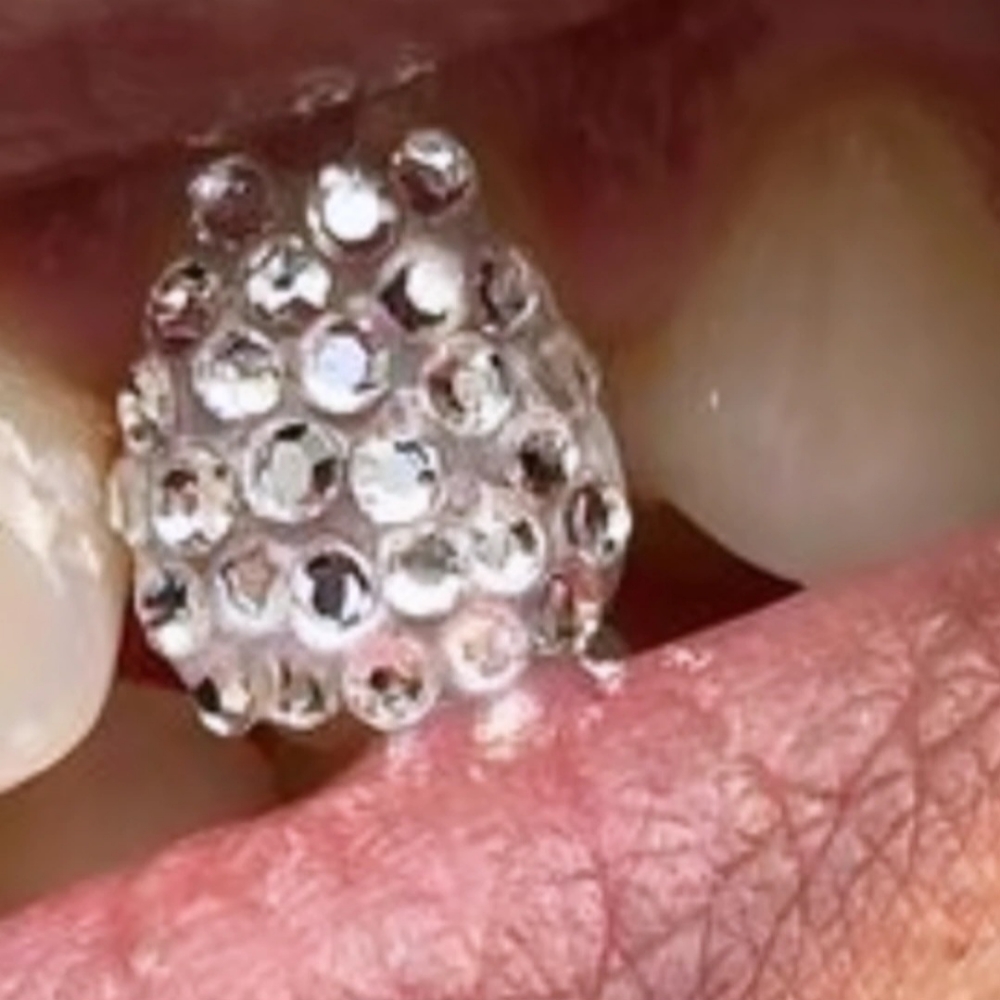 Disco Ball 1 Tooth