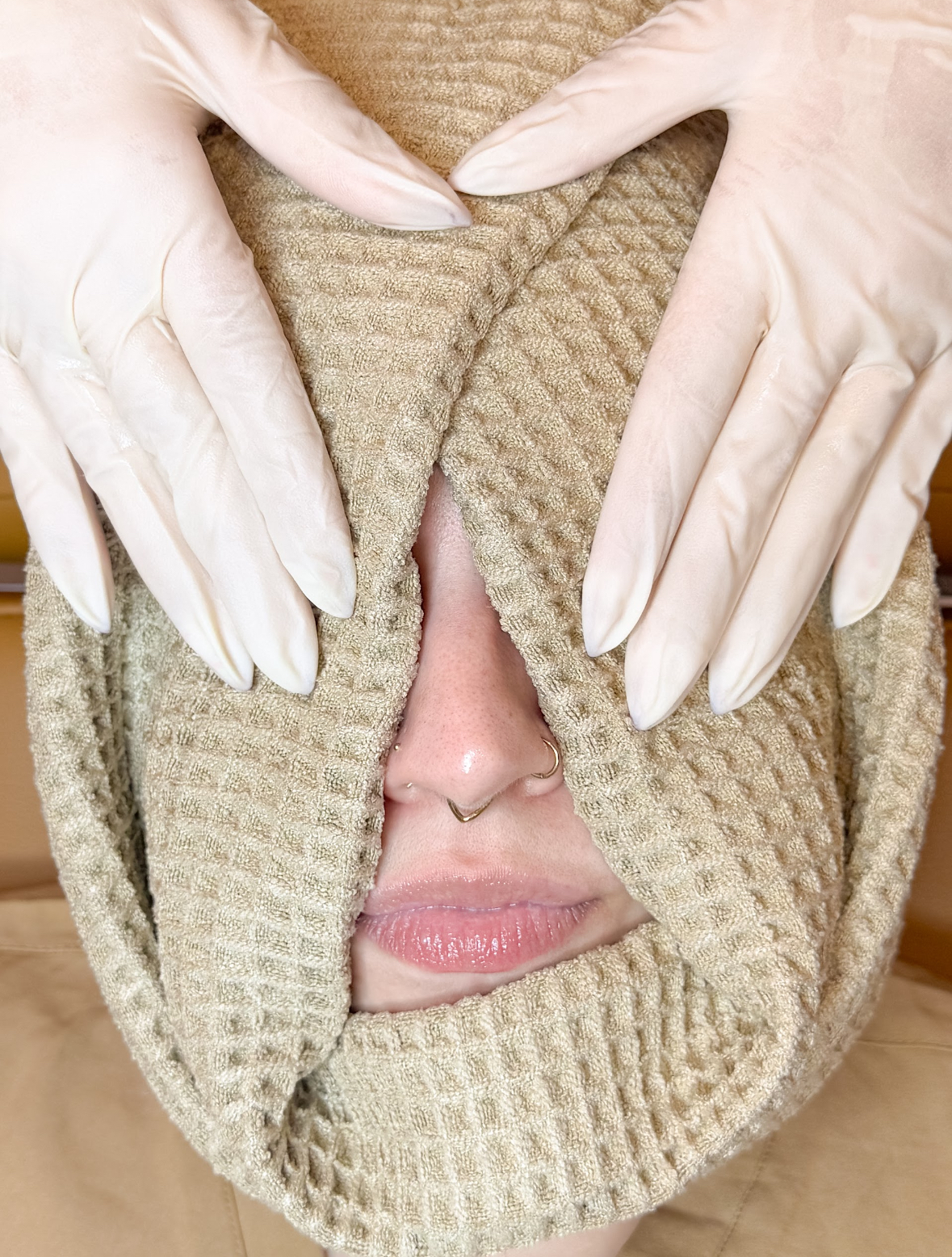 Acne Facial