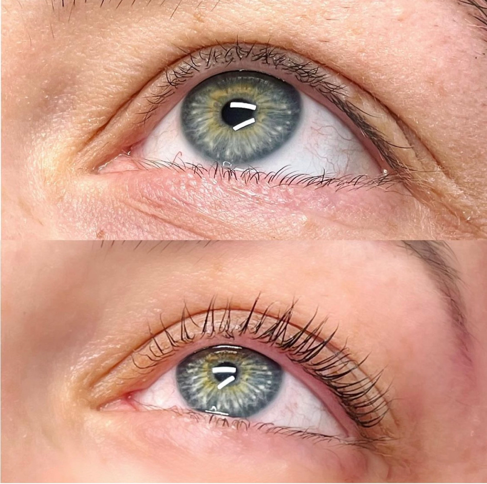 Lash Lift