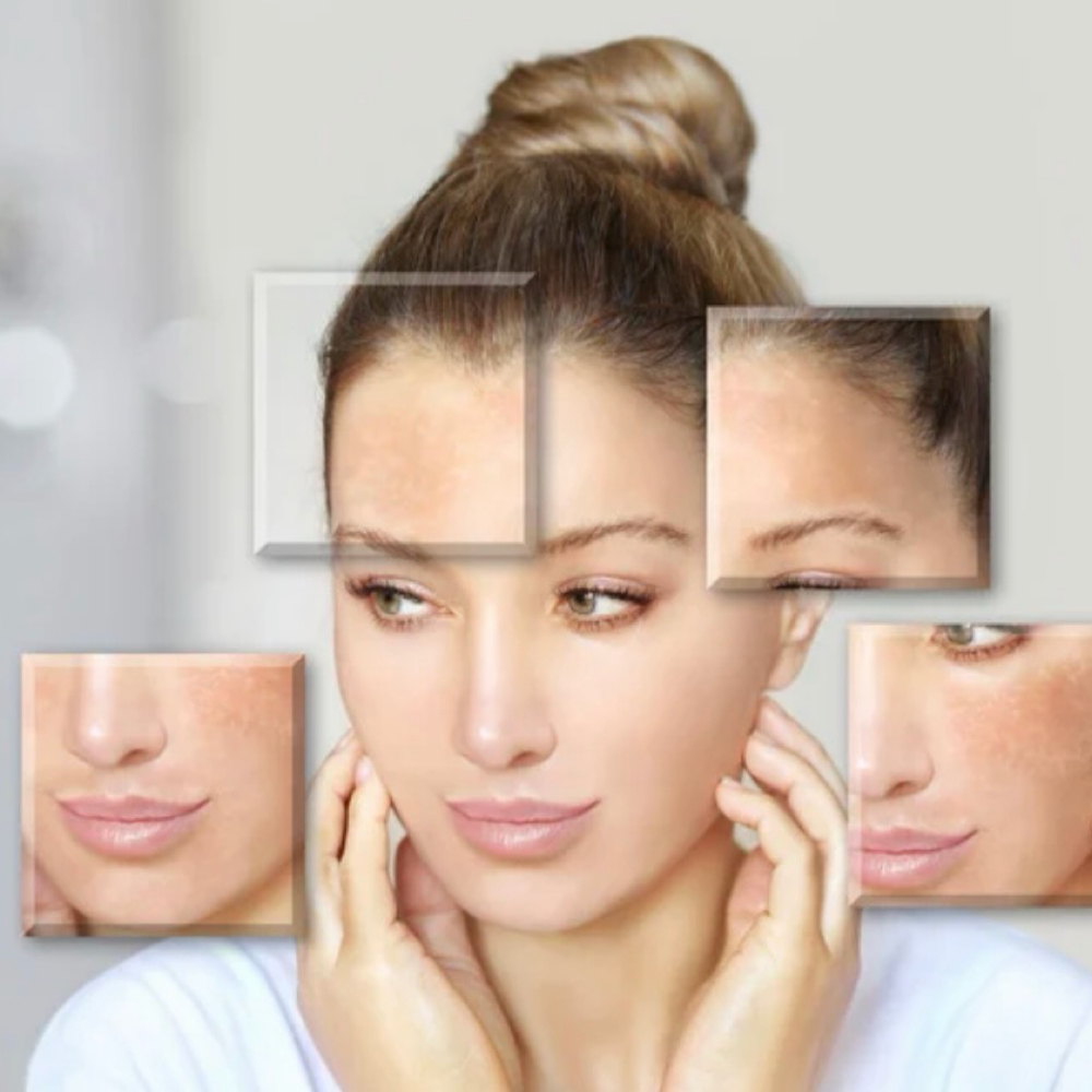 Skin analysis at Island Glow in Londonderry, NH