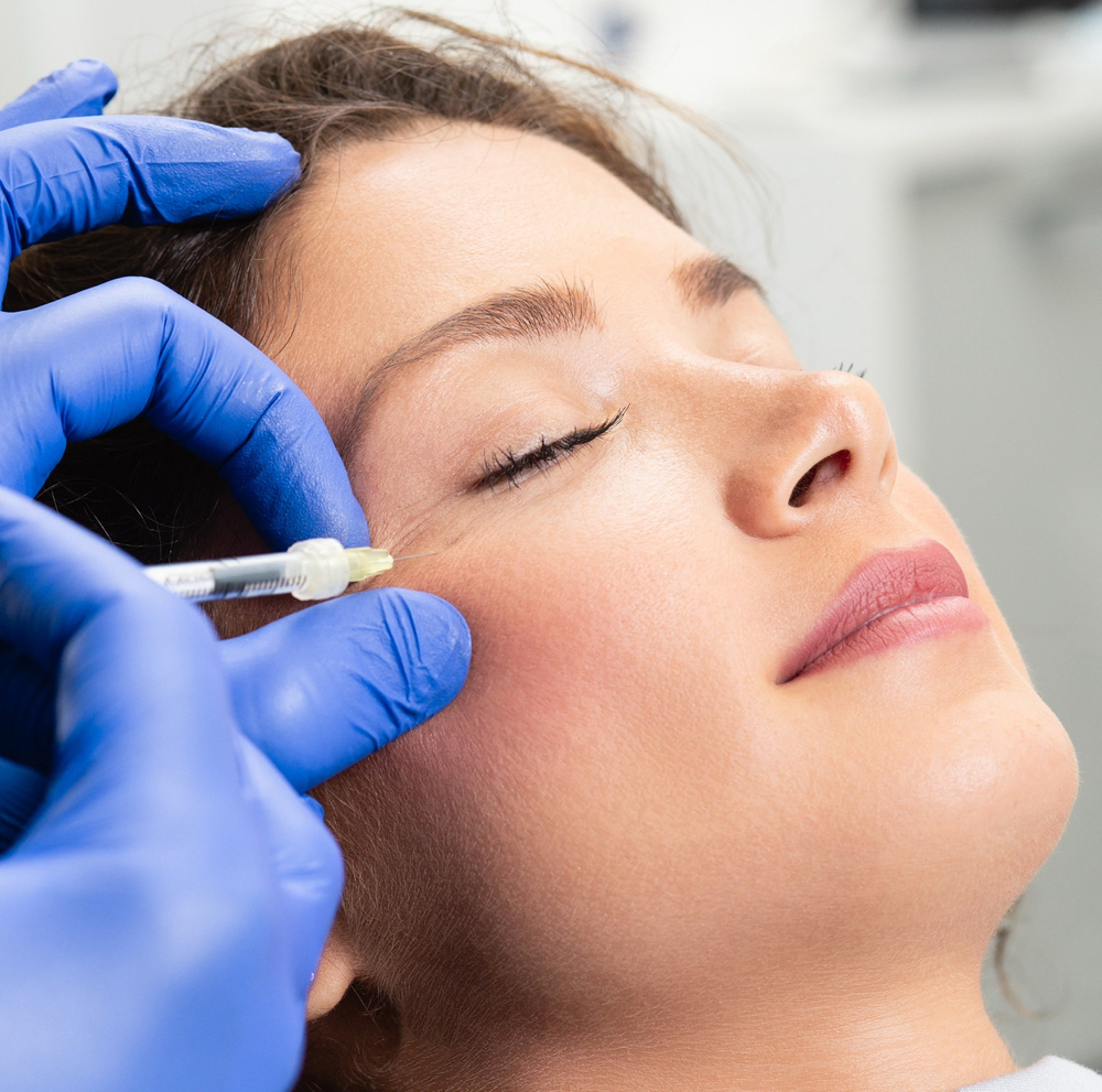 Neurotoxin- $10/unit CROWS FEET