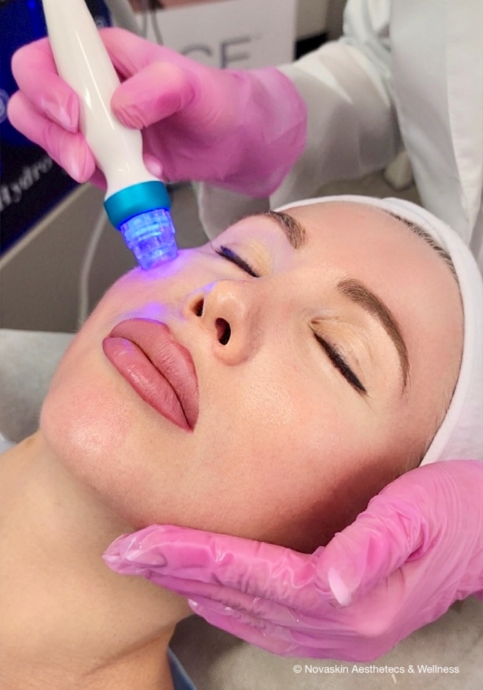 ✨ Hydration Facial