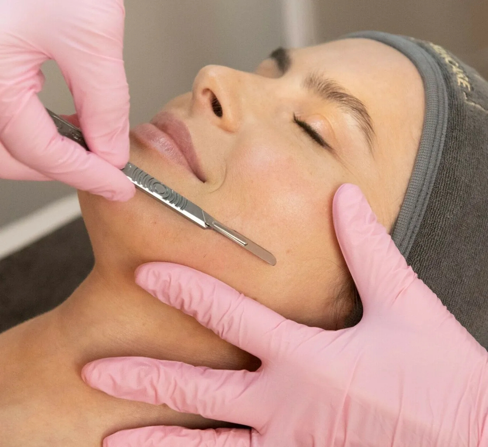 Dermaplaning Facial