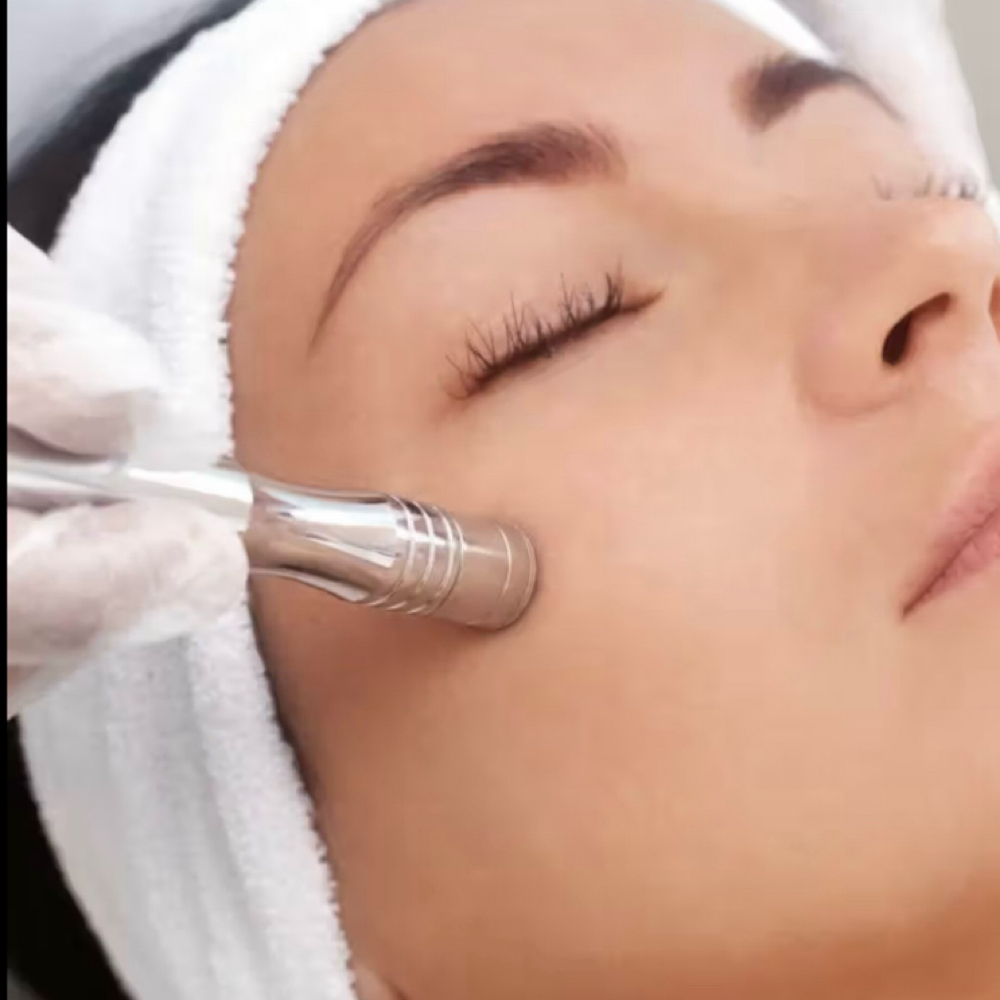 Microdermabrasion Facial