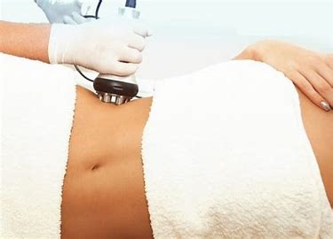 RF Stomach Treatment