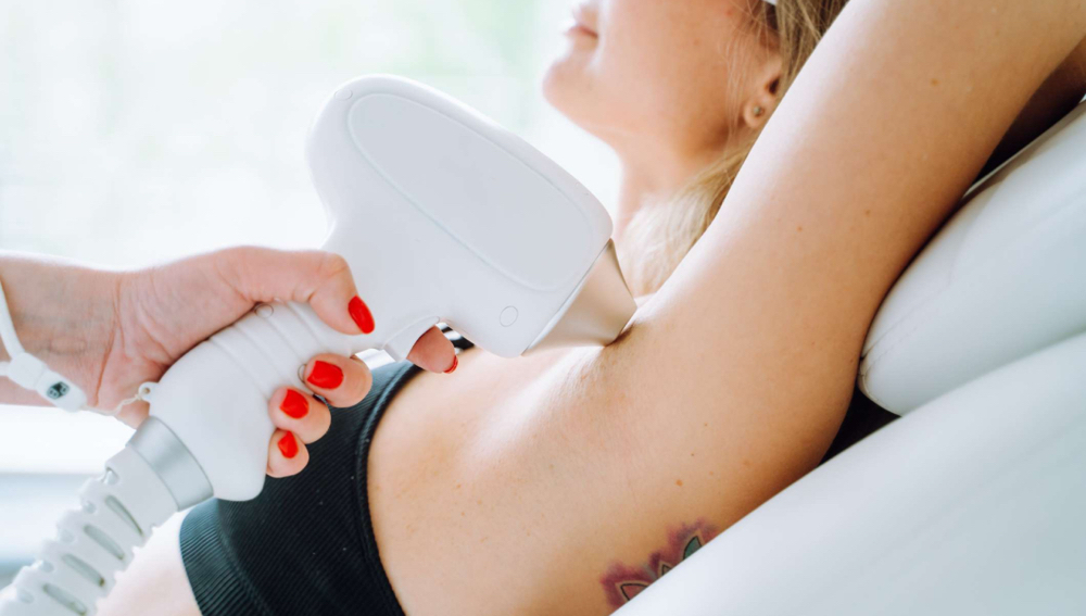 Laser Hair Removal - Small Area