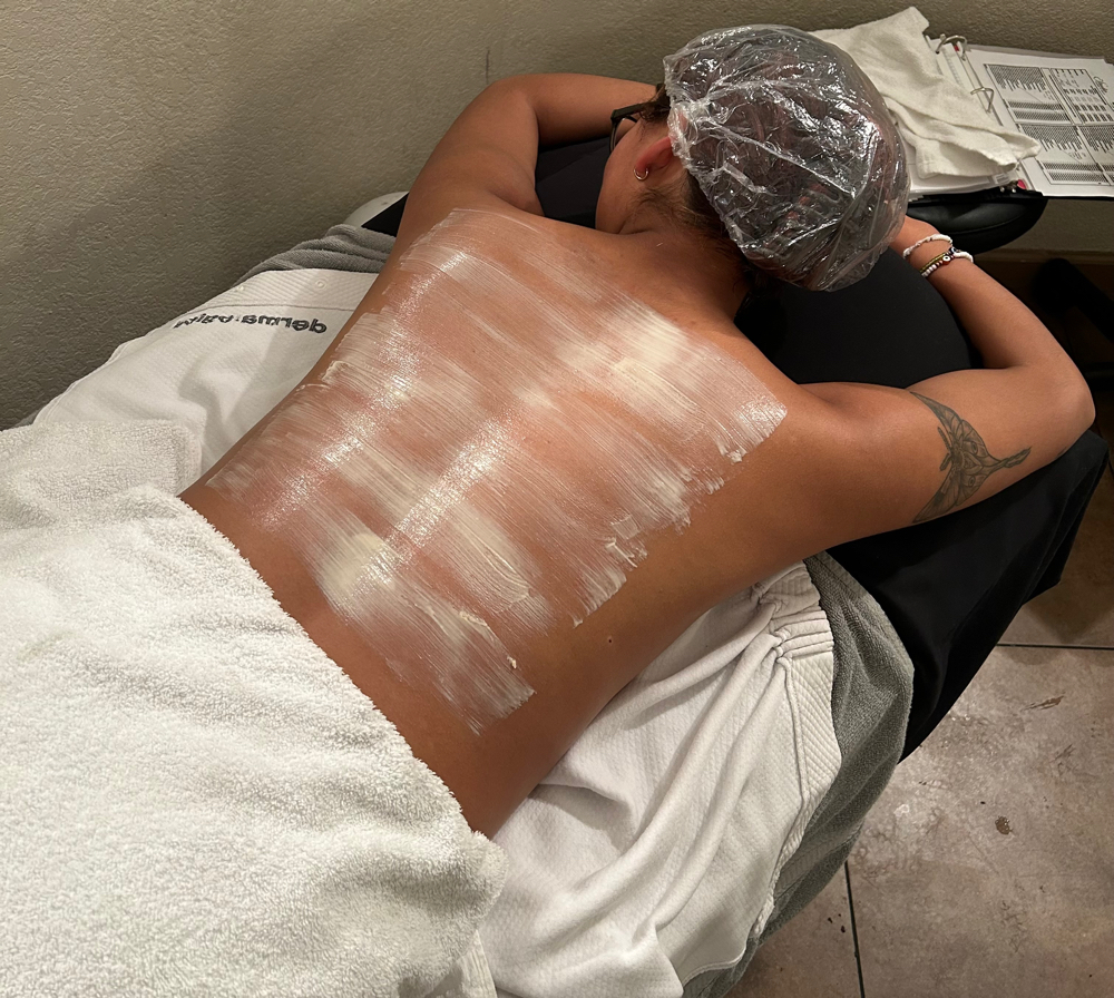 detoxifying back treatment
