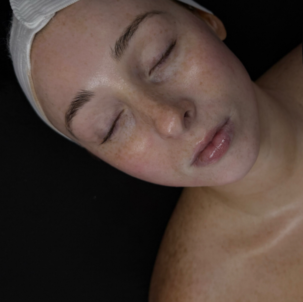 Custom Facial at Allure in Colonie, NY