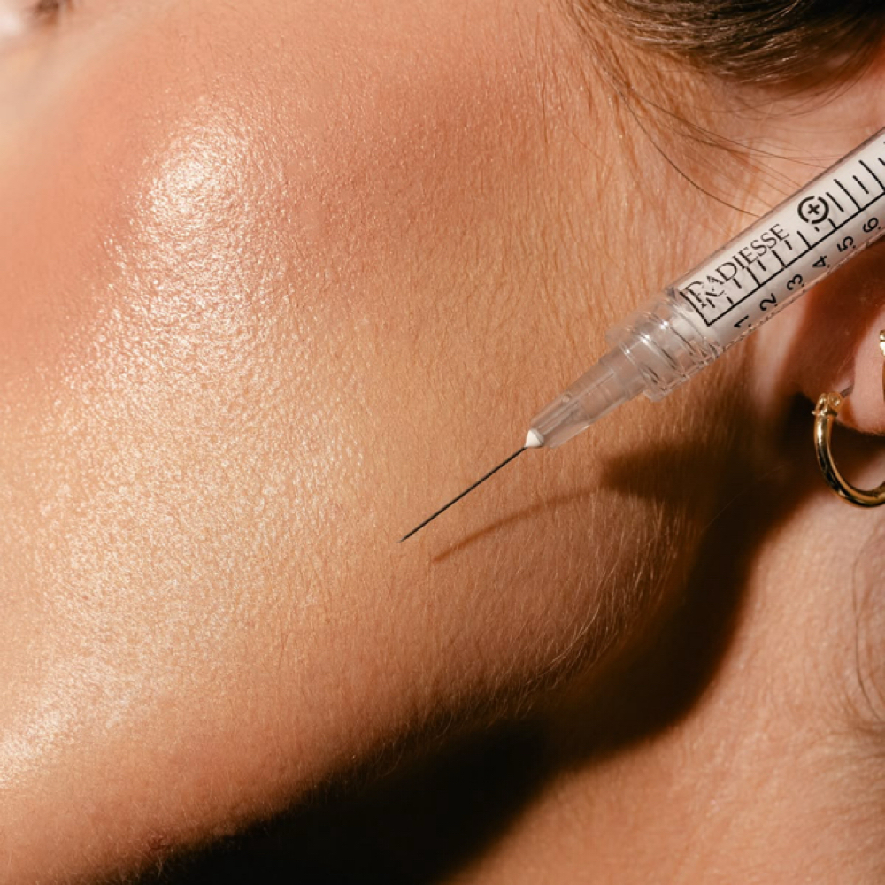 Neuromodulator + Filler at Meraki Advanced Aesthetics in Willis, TX