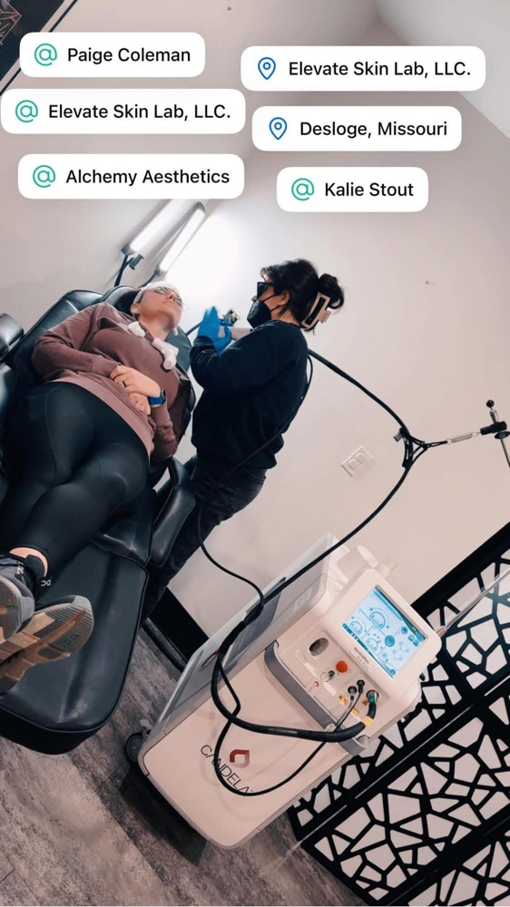 Laser Facial