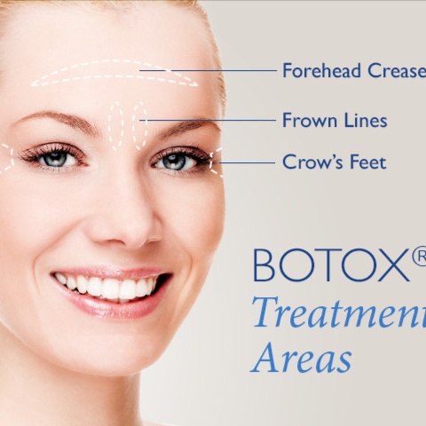 Botulinum Toxin at A Better You Viewpoint in Prescott Valley, AZ