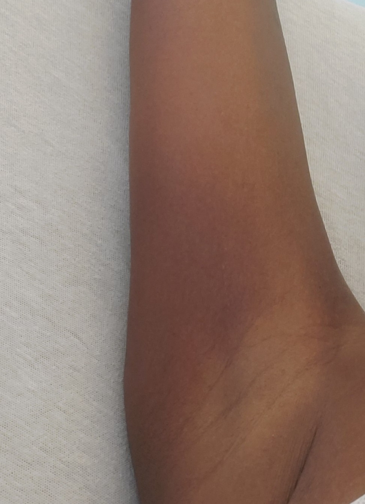 Underarm Waxing