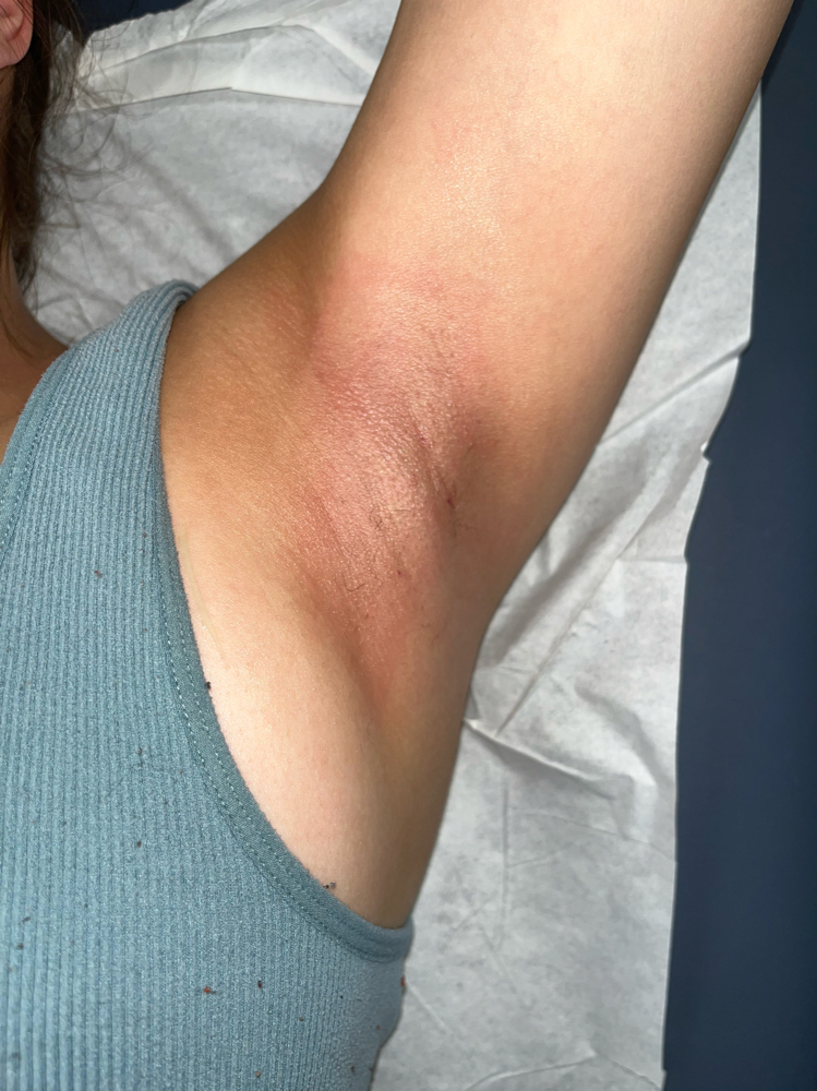 Underarm Wax
