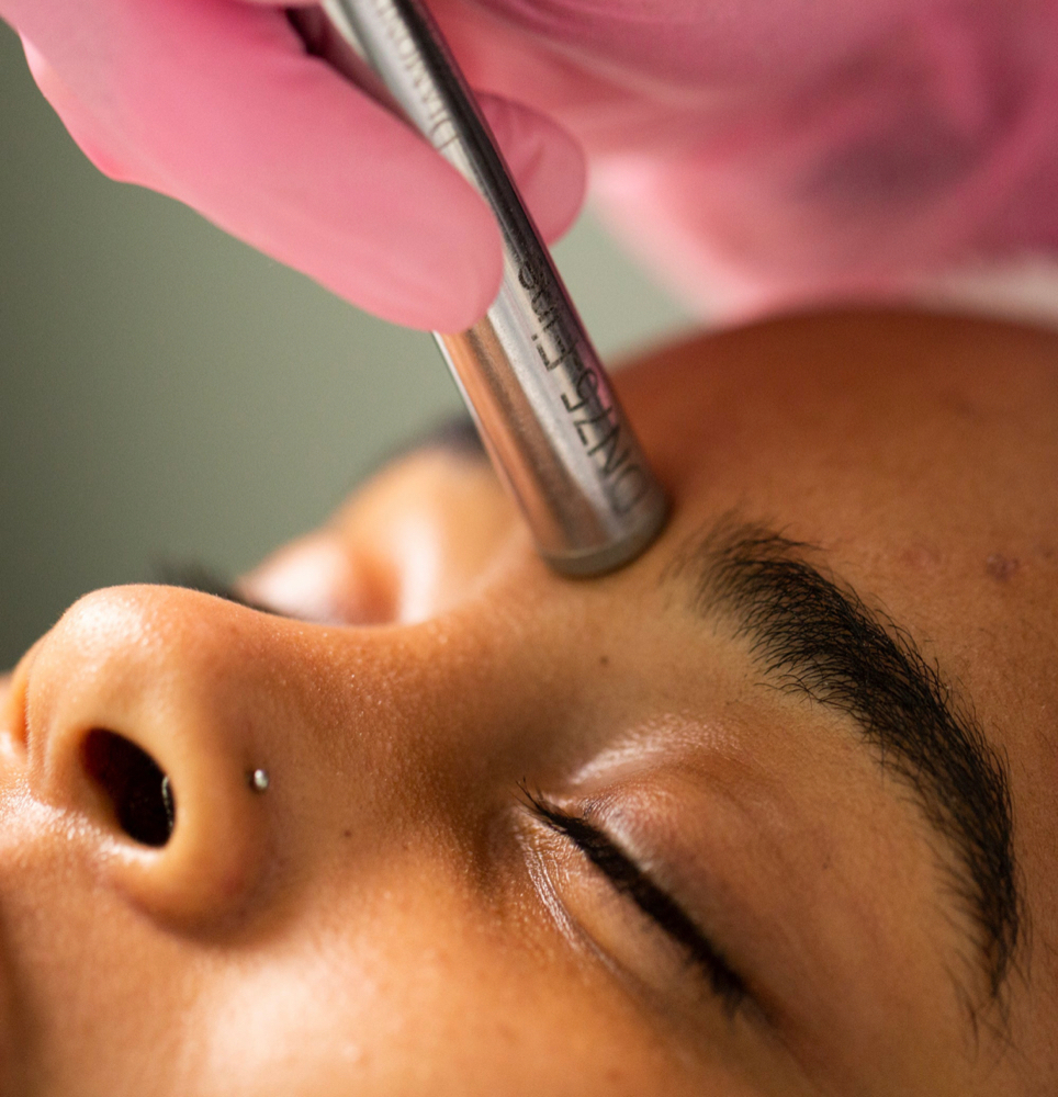 Microdermabrasion Facial (60 Min)