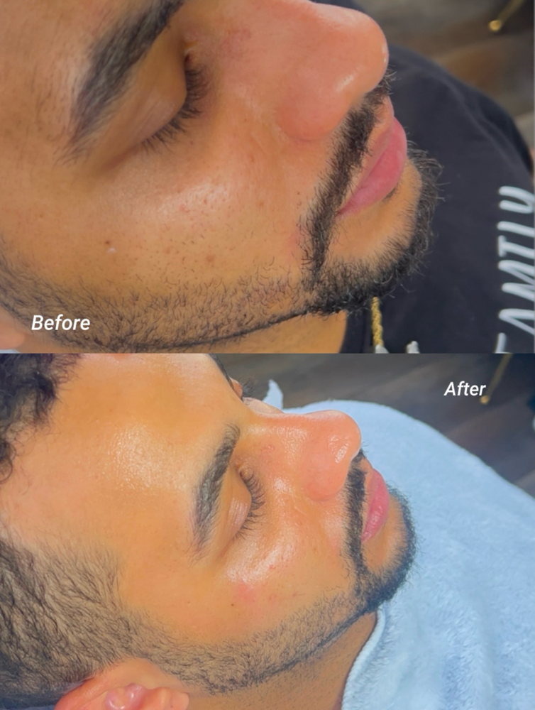 Fathers Day Facial