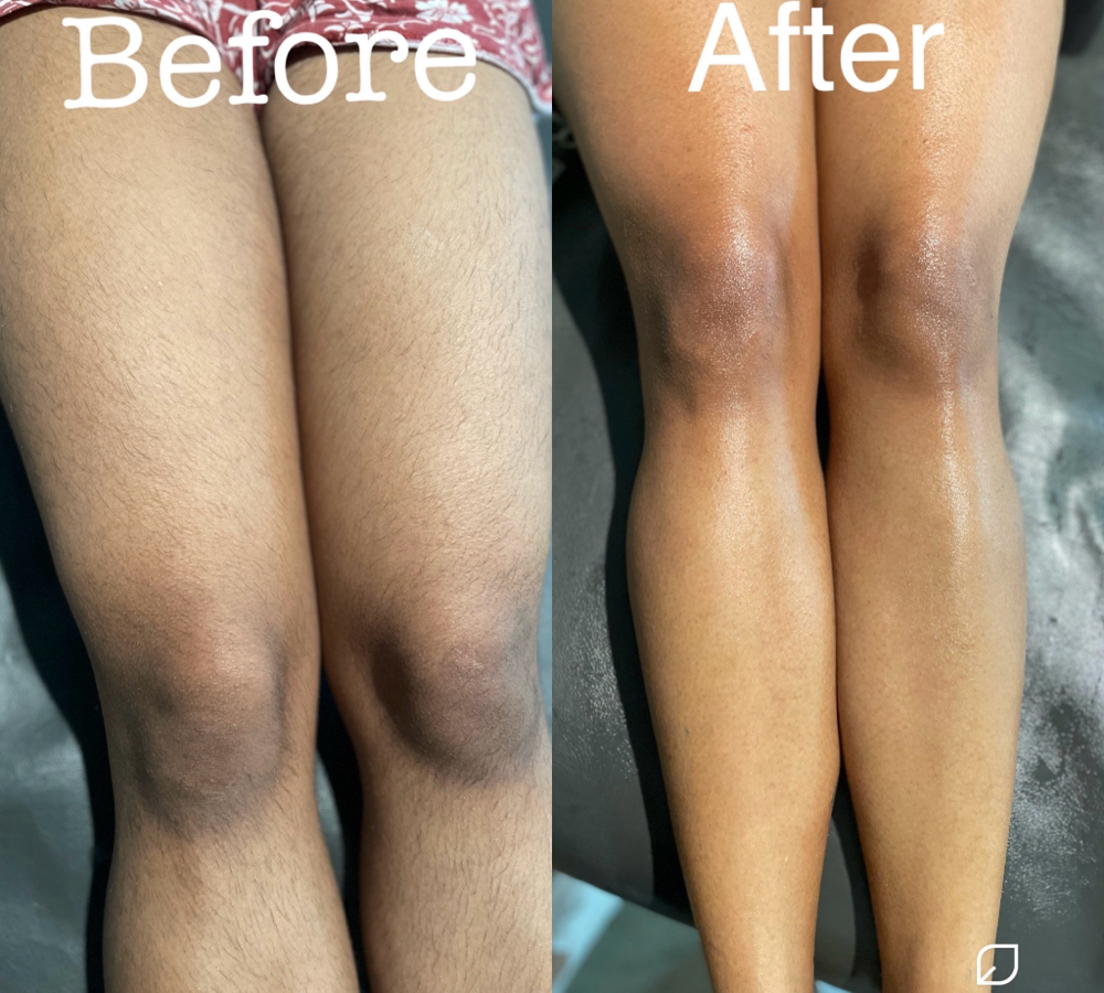 Full Leg Wax