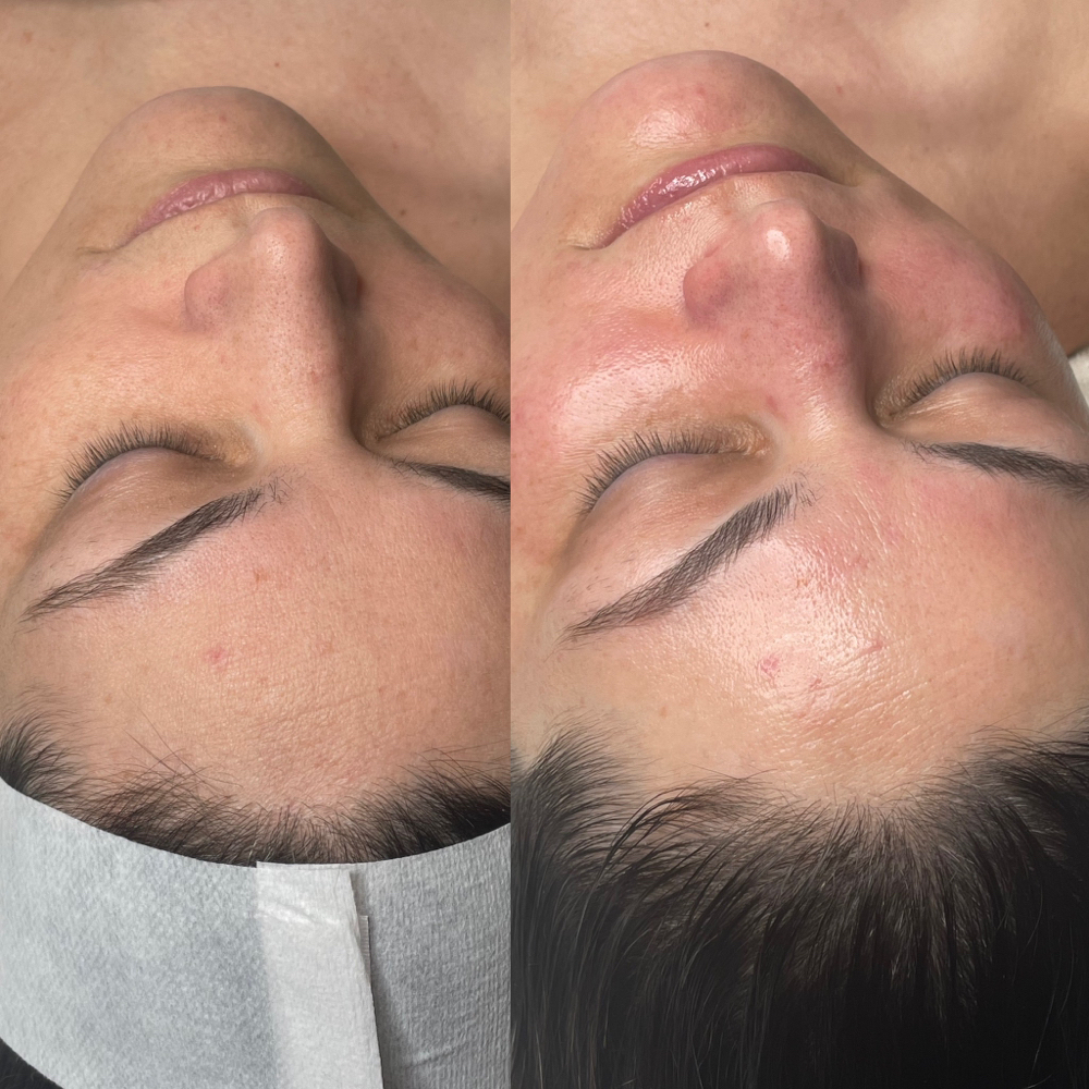 Deluxe Hydro Glow Facial