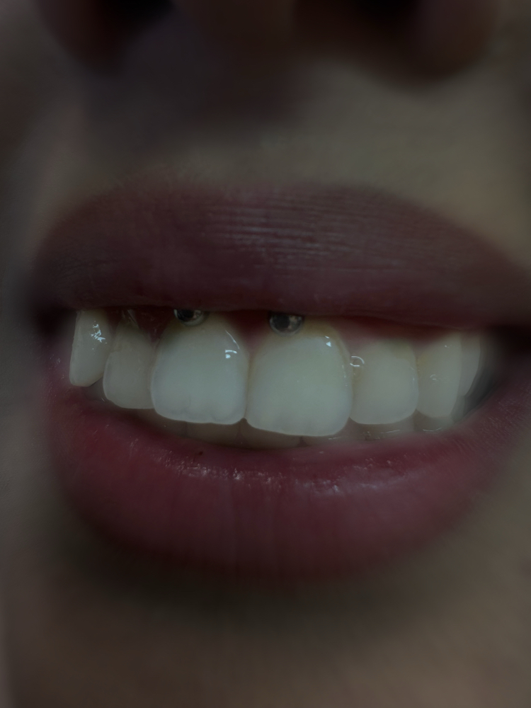 Smiley at Bodyart By Emerald Esme 🖤🕷️ in El Centro, CA