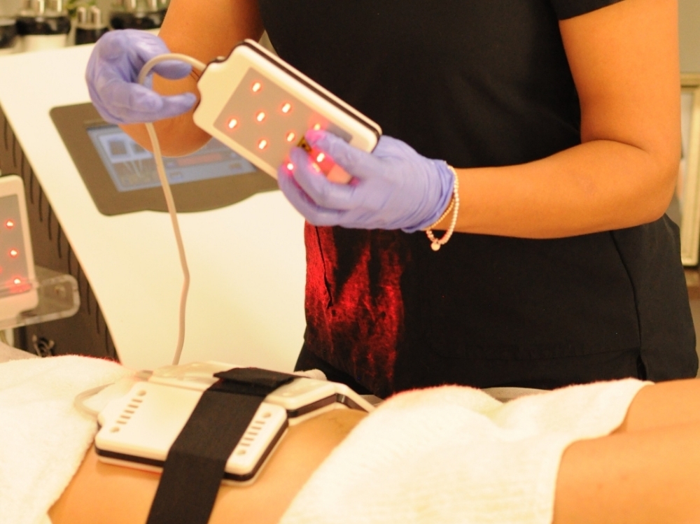Laser Lipo