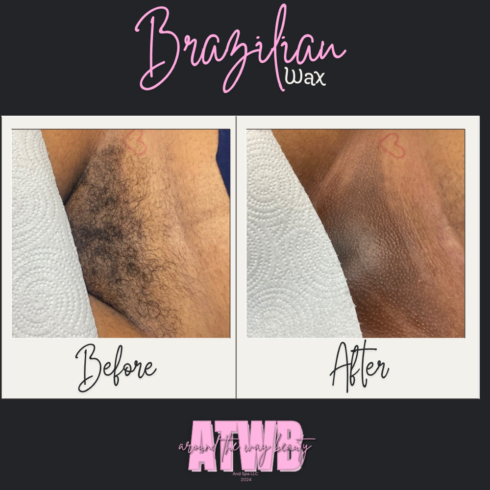 Brazilian Wax